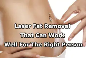Laser Fat Removal That Can Work Well For The Right Person