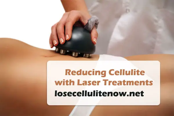 Reducing Cellulite with Laser Treatments