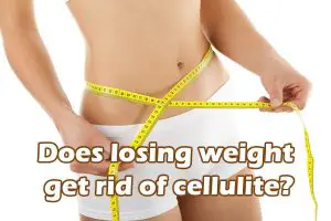 Does losing weight get rid of cellulite