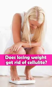 Does losing weight get rid of cellulite