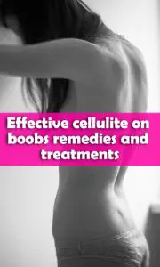 Effective cellulite on boobs remedies & treatments