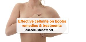 Cellulite on boobs