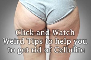 get rid of Cellulite