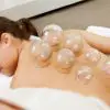 Cupping for Fibromyalgia