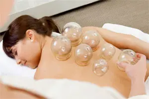Cupping for Fibromyalgia