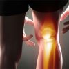 what causes knee pain