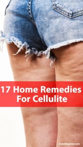 17 Home Remedies For Cellulite