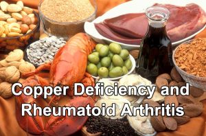 Copper Deficiency Rheumatoid Arthritis