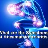 What are the Symptoms of Rheumatoid Arthritis