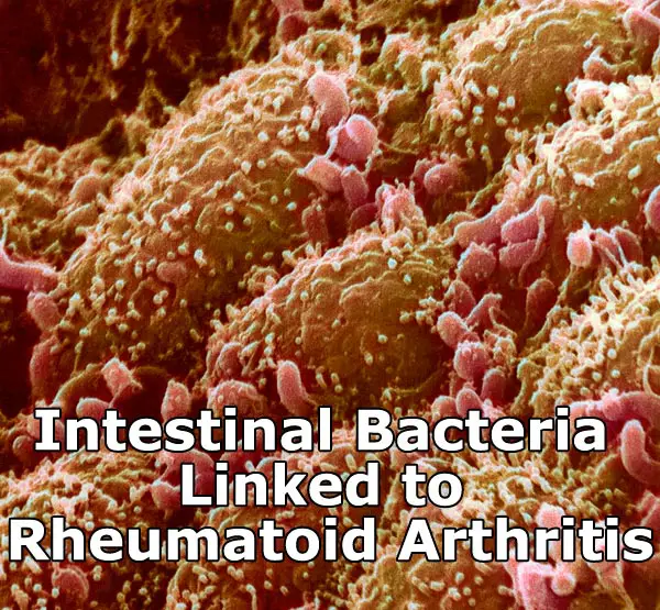 Intestinal Bacteria Linked to Rheumatoid Arthritis