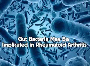 Gut Bacteria May Be Implicated in Rheumatoid Arthritis